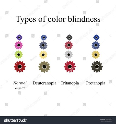 Types Color Blindness Eye Color Perception Stock Vector Royalty Free