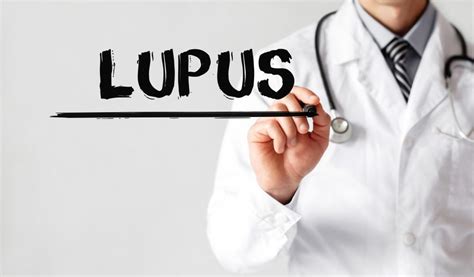 Lupus — What Are Common Triggers For Flares West County Rheumatology