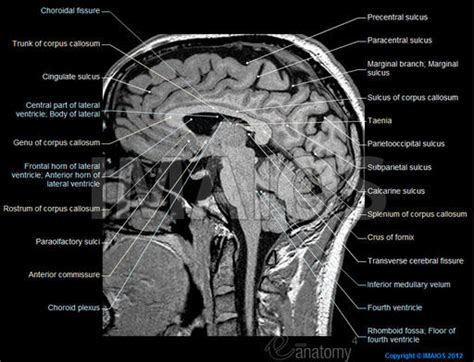 Magnetic Resonance Imaging Of Brain Mri Brain