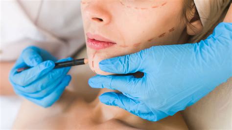 How Plastic Surgery Trends Are Influenced By Region Allure