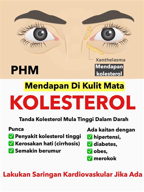 Petua Turunkan Kolesterol Dengan Cepat - Info-Sihat.My
