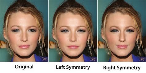 Starecta then can do three things to your face: Boston Face Asymmetry correction without surgery, with ...