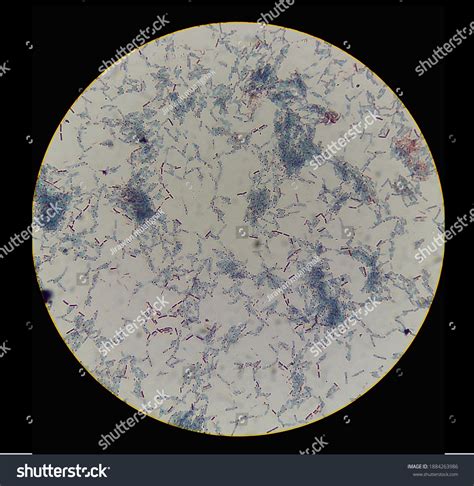 Endospore Staining Cell Bacillus Cereus Endospores Stock Photo