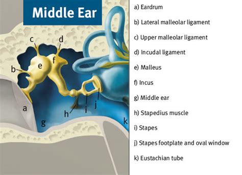 Otosclerosis And Tinnitus Causes Symptoms And Treatment Tinnitus