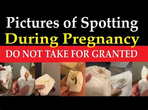 Pictures Of Spotting During Pregnancy If You Notice Them Kindly See