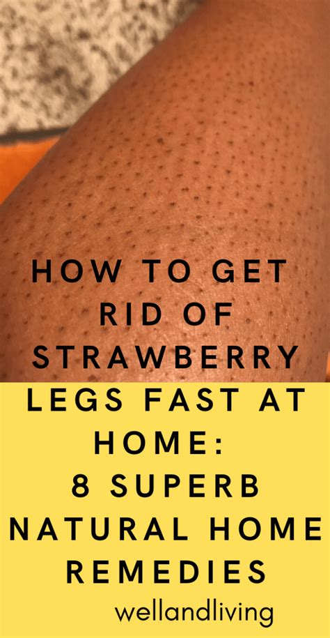 How To Get Rid Of Strawberry Legs Fast At Home 8 Superb Natural Home