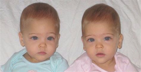 Identical Twins Were Born In 2010 Now Theyre Dubbed ‘the Most