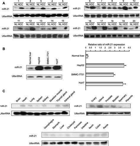Microrna 21 Acts As An Oncomir Through Multiple Targets In Human