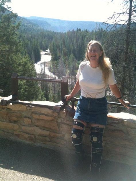 Therapeutic Or Barbaric Utah Woman Wants Doctors To Paralyze Her The