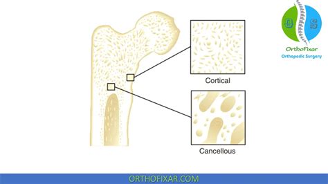 Bone Types Easy Explained Orthofixar 2024