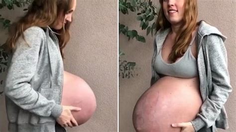Pregnant With Triplets Belly Telegraph