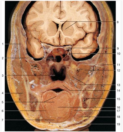 Coronal Section At Sphenoidal Sinus Level Diagram Quizlet