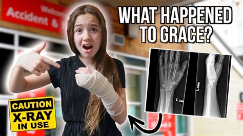 She Broke Her Arm 😢 Youtube