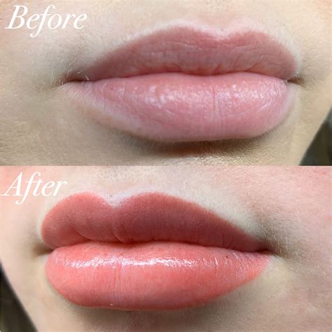 Professional Lip Blushing Services And Contouring Procedure