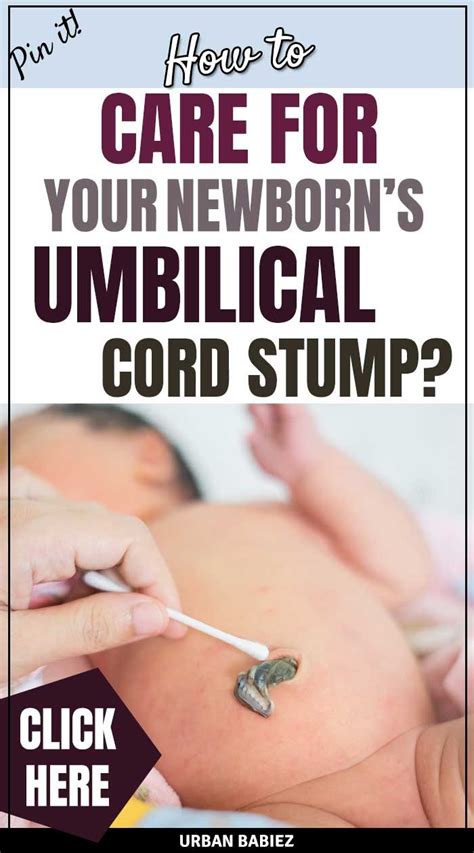 How To Care For Your Newborns Umbilical Cord Stump Urban Babiez