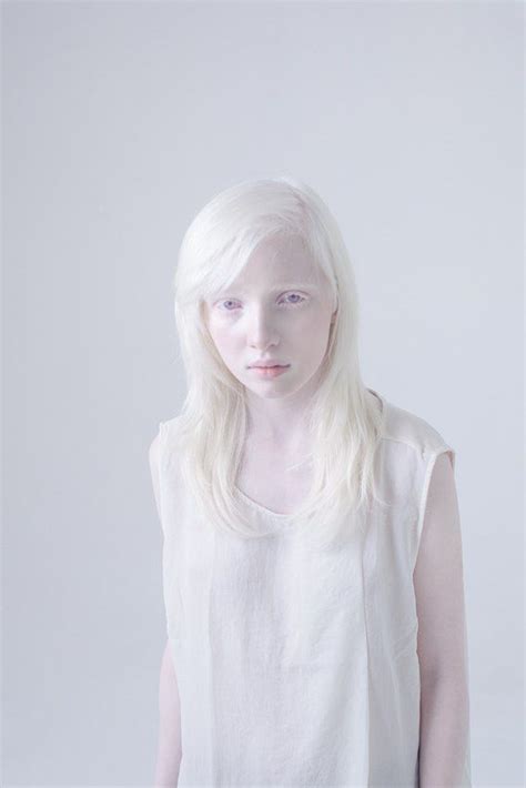 Albino By Анна Данилова Via Behance Albino Model Albino Girl Pale