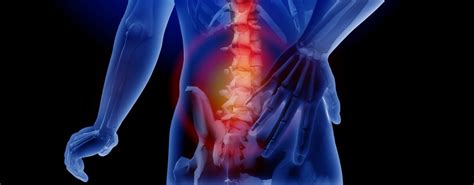 Back Pain And Sciatica Colorado Springs Co Joint Effort Physical Therapy