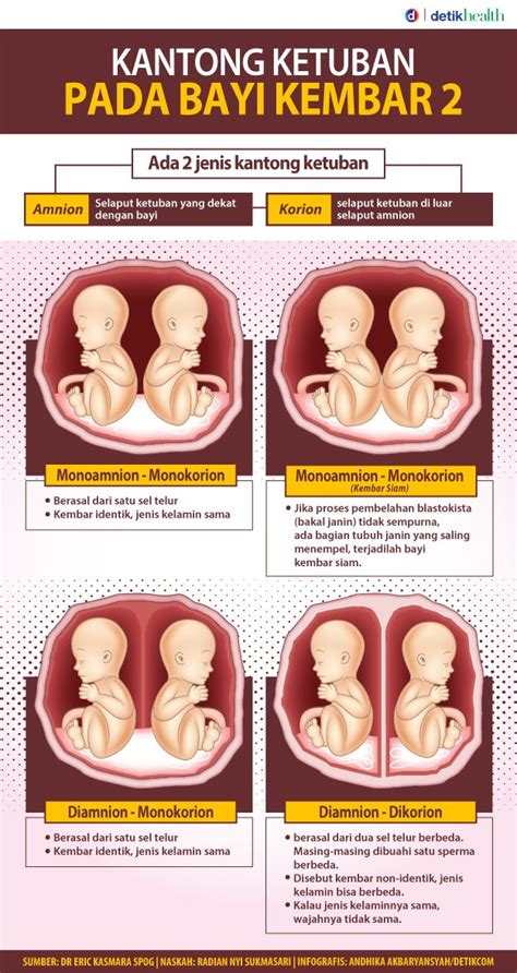 Infografis Macam Macam Kondisi Kantong Ketuban Bayi Kembar Dua