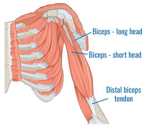 Distal Biceps Tendonitis Causes And Treatment
