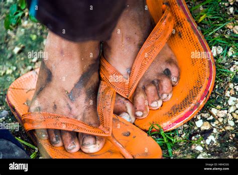 Laufend Fluss Taube Dirty Feet Sandals Schwanger Sich Anstrengen Rustikal