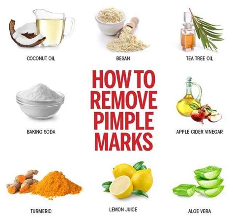 How To Remove Pimple Marks Effective Ways In 2021 How To