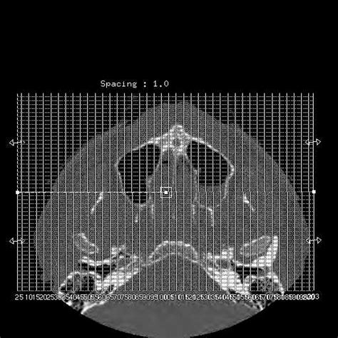 Facebook Fractures