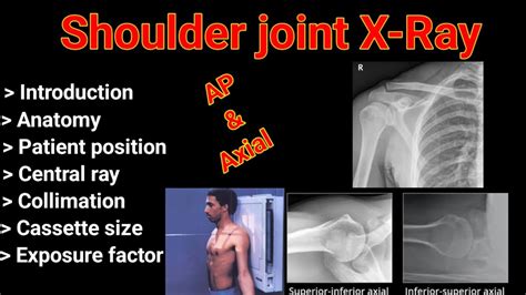 Shoulder Joint X Ray Ap And Axial View By Bl Kumawat Youtube