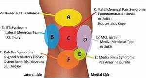 Our Knee Diagnosis Chart Helps You To Work Out What Is Causing