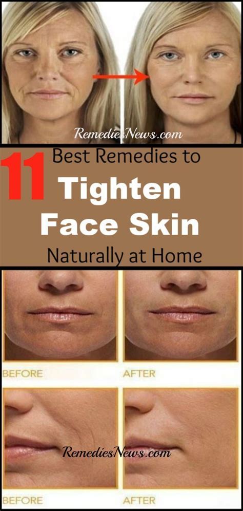 11 Best Remedies To Tighten Face Skin Naturally At Home