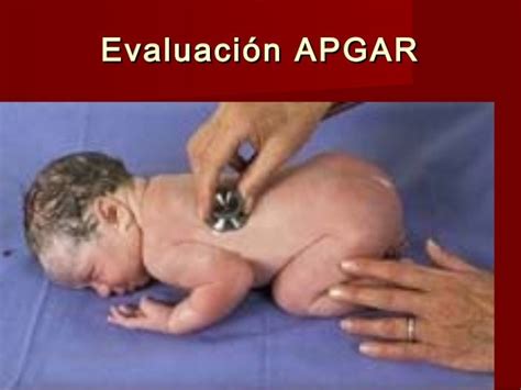 Test Apgar Del Recién Nacido