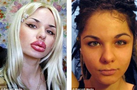 Самые большие губы в мире принадлежат россиянке Неопознанное