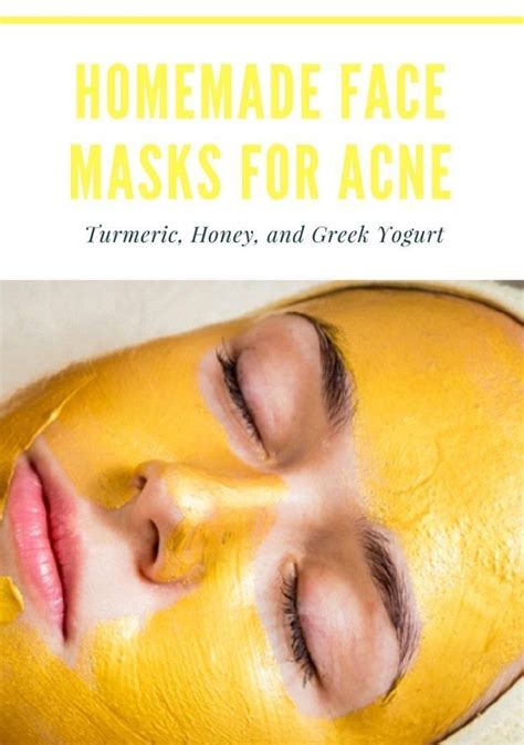 Pin On Heal Acne Scars