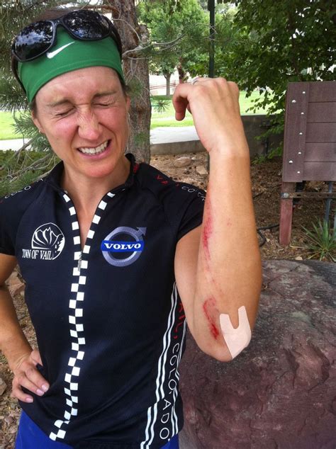 Treat Road Rash Lindaau