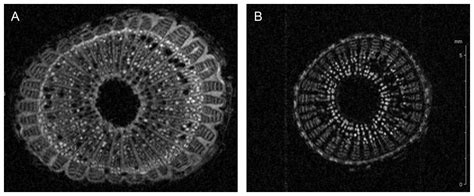 Check spelling or type a new query. Sequence/structural analysis of xylem proteome emphasizes ...