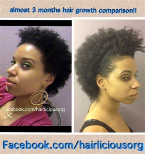 Hair will typically start to grow as thin, colorless, and wispy and continue to mature up to 18 months. 1 month length check comparison! 2/12 month growth ...