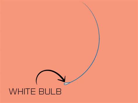 They must be, because only the follicles in this area of neck are large white bulbs like that. The Ultimate Solution For White Bulb On Hair That You Can ...