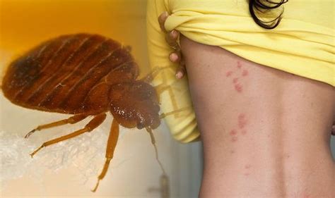 Bed Bugs Blood Stains And Shell Casings Are Some Of The Main Signs Of