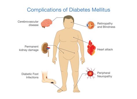 Hb A1c And The Risk Of Developing Complications In Type 2 Diabetes