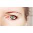 What Is Pink Eye  Aka Conjuctiivitis Dr Barry Lenoard
