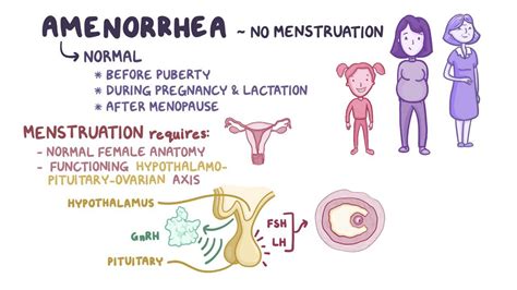 Amenorrhea Clinical Video Anatomy Definition Osmosis