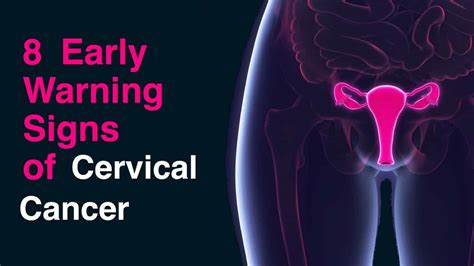 Other symptoms and signs that may accompany the condition include vaginal discharge, pelvic pain, and pain during sexual intercourse. 8 Early Warning Signs of Cervical Cancer