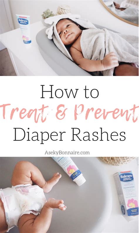 How To Treat And Prevent Diaper Rashes Aseky Co Diaper Rash Diaper Rash Treatment Baby Rash