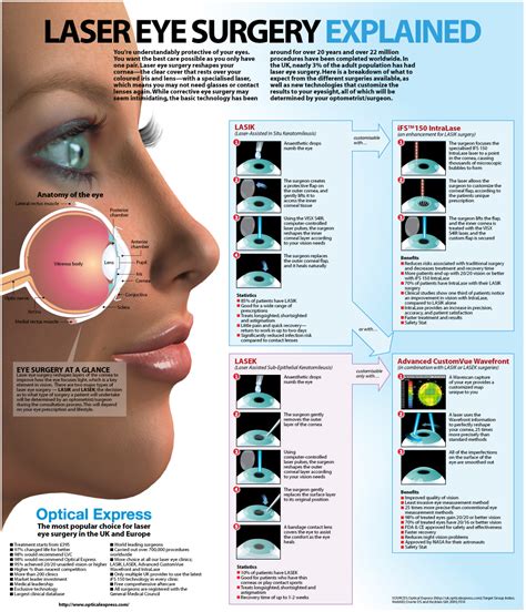 Most people get lasik surgery around the because eyesight continues to change until about 24, many doctors won't do lasik eye surgery on patients under 25 years old. Laser Eye Surgery Explained | Visual.ly