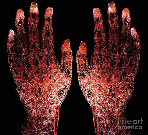 Blood Vessels Of Human Hands Injected With Resin Photograph By Zephyr