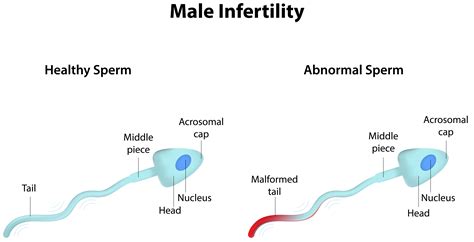 Cure Men Fertility Naturally Find Out The Most Easy And Effective Ways
