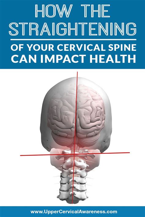 How The Straightening Of Your Cervical Spine Can Impact Health Artofit