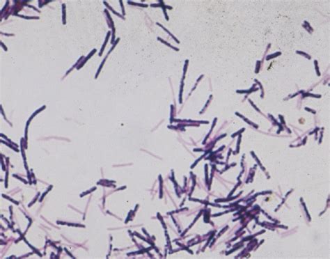The spore is the dormant state of the bacteria and can exist under conditions where the vegetative cell cannot. Should I have my pet tested for Clostridium difficile ...