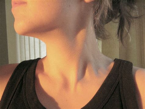 Signs Of Thyroid Cancer Business Insider
