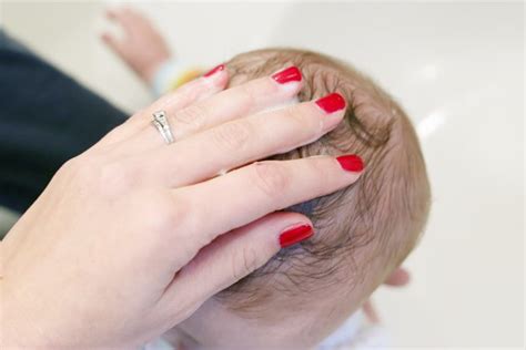 How To Treat Dry Scalp In Babies