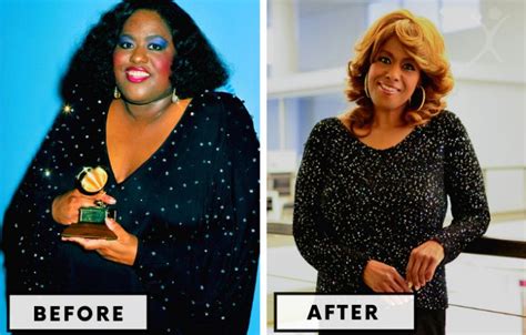 Top 21 Celebrity Bariatric Surgery Transformations